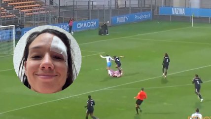   Christiane Endler recibió puntos de sutura en un ojo tras partido ante Marsella 
